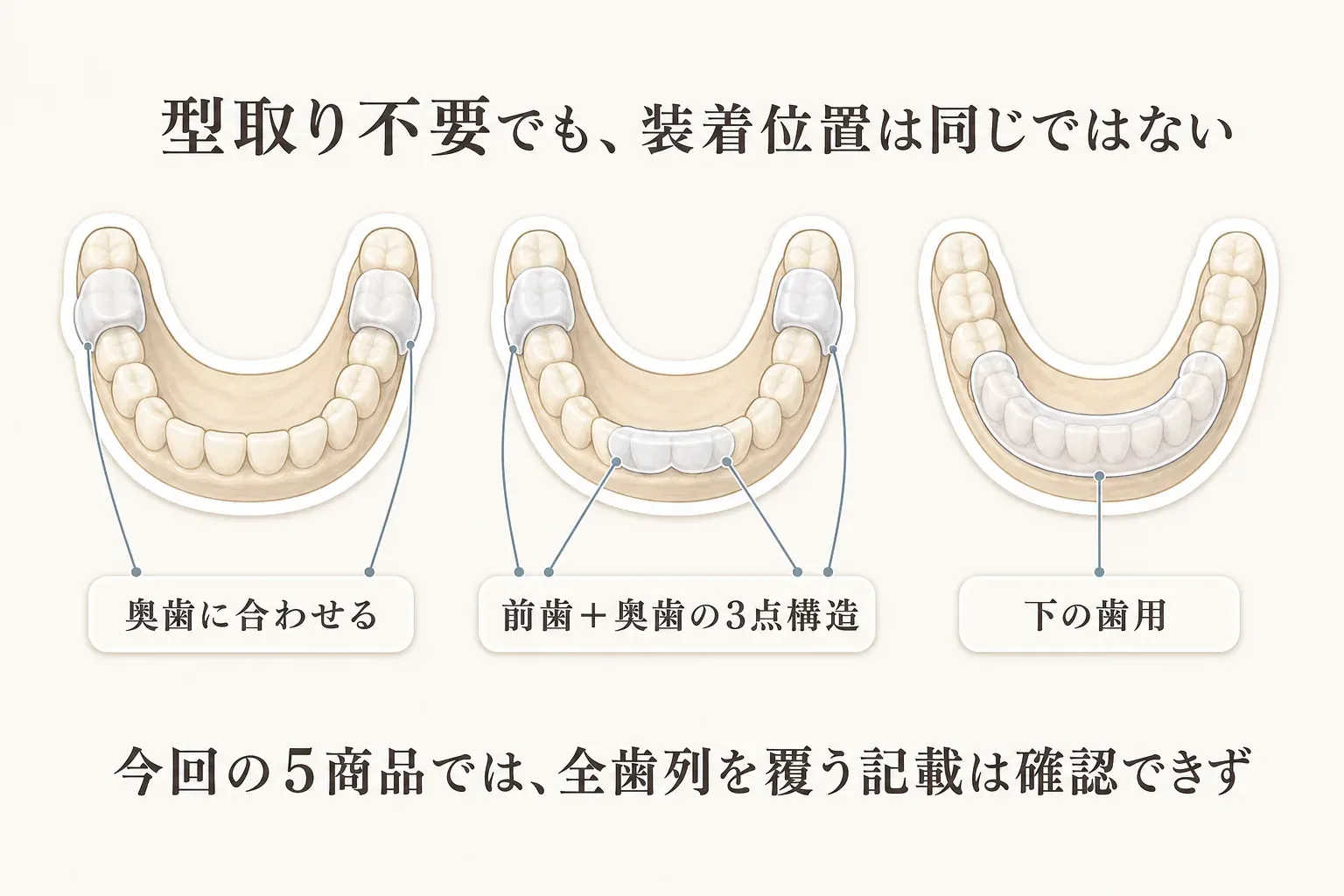 型取り不要のマウスピースでも装着位置は異なることを示す図。奥歯に合わせるタイプ、前歯と奥歯の3点構造、下の歯用の3種類を歯列図で比較し、今回の5商品では全歯列を覆う記載を確認できないことを示している。